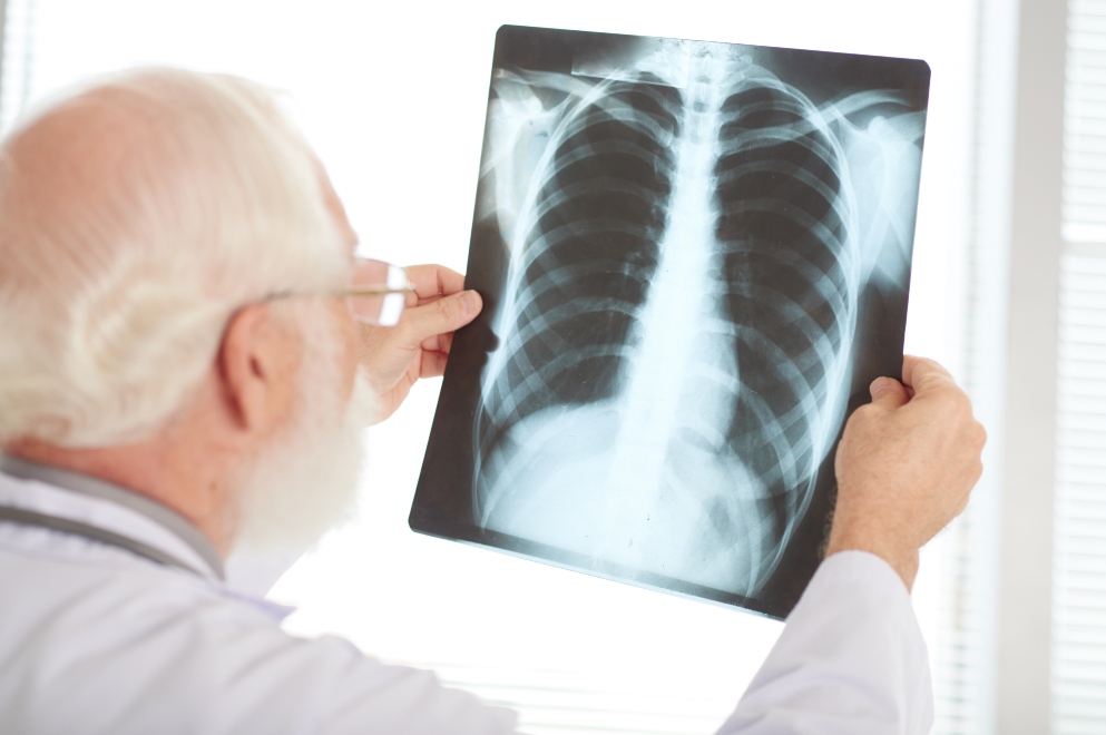 Tuberculosis: una problemática actual y en aumento